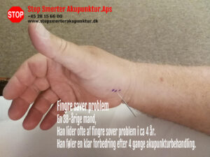 Fingre sover i Frederiksberg