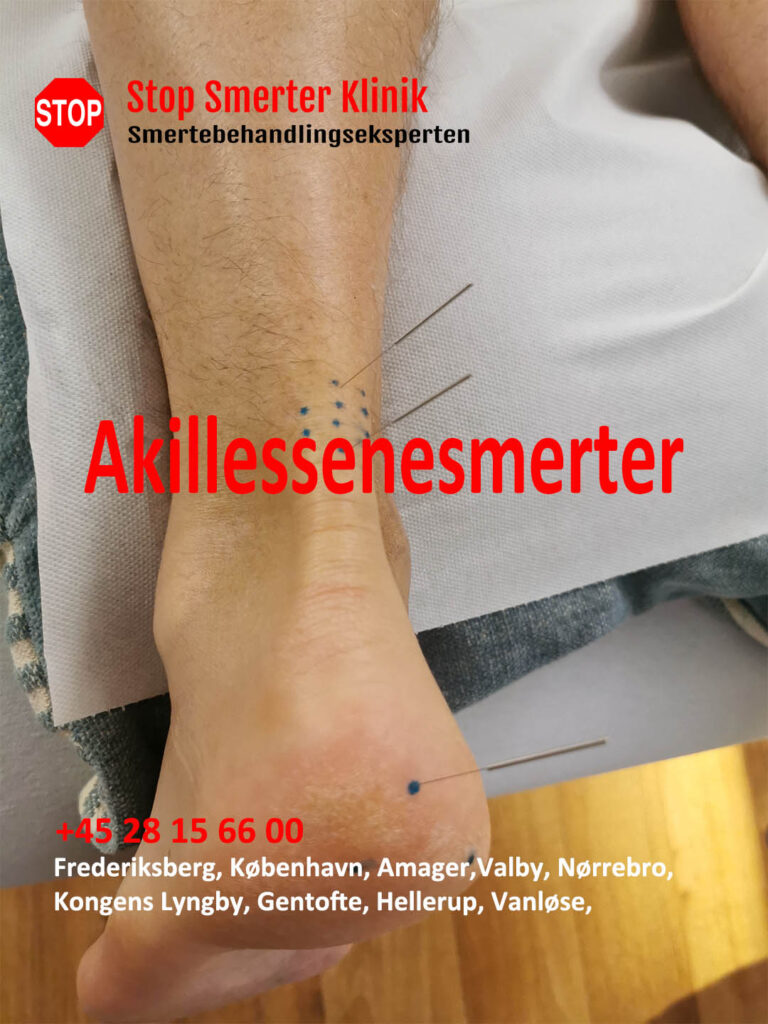 Akillessenesmerter i Frederiksberg